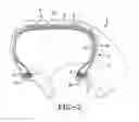 Fig. 03 - Tire with rubber sidewall containing internal electrically conductive rubber strip