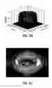 Fig. 06 - Integrated electrostatic inductive coupling for plasma processing