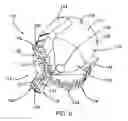 Fig. 05 - Bits for use in drilling with casting and method of making the same