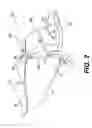 Fig. 03 - Side panel for a recreational vehicle