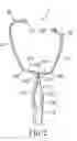 Fig. 03 - Stethoscope