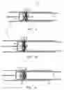 Fig. 04 - Self locking apparatus