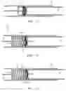 Fig. 05 - Self locking apparatus