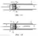 Fig. 07 - Self locking apparatus