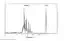 Fig. 02 - Methods of selective capillary electrophoresis