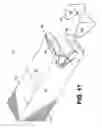 Fig. 12 - Dispenser with detachable retention feature