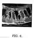 Fig. 05 - Method of making and using a hollow fiber microfiltration membrane