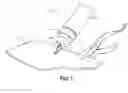 Fig. 02 - Plasma arc cutting torch nozzle