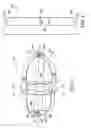 Fig. 02 - Medially stabilized liquid surge suppressor