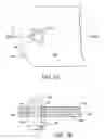 Fig. 06 - Medially stabilized liquid surge suppressor