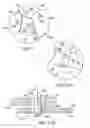 Fig. 09 - Medially stabilized liquid surge suppressor