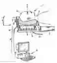 Fig. 01 - Gaseous detector imaging device and surgical installation including such device