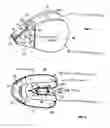 Fig. 05 - Airbag and airbag device