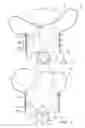 Fig. 03 - Apparatus and method for controlling an inflatable cushion