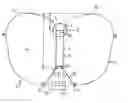 Fig. 01 - Gas bag