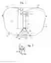 Fig. 02 - Gas bag