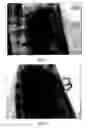 Fig. 02 - Process for forensic tissue rehydryation and finger ridge enhancement