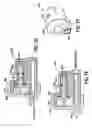 Fig. 09 - Fluid delivery system including a valve and a pressure transducer
