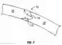 Fig. 04 - Contact lens