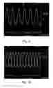 Fig. 07 - Method and system for the conversion of phase shift keying signals (PSK) into amplitude shift keying signals (ASK)
