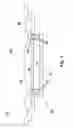 Fig. 02 - Audio speaker and method for assembling an audio speaker