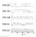 Fig. 06 - Optical transmitter for generating duobinary CSRZ and CSRZ-DPSK optical signals for use in optical communication system