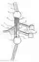 Fig. 01 - Cable system and method for laying cable