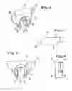 Fig. 04 - Tool and method for the machine working of workpieces