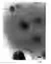 Fig. 07 - Microparticles and methods for their production