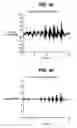 Fig. 06 - Method and system for characterizing tactile perception