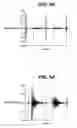 Fig. 08 - Method and system for characterizing tactile perception