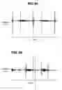 Fig. 10 - Method and system for characterizing tactile perception