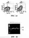 Fig. 06 - Method and composition for treating immune complex associated disorders
