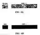 Fig. 09 - Method and composition for treating immune complex associated disorders