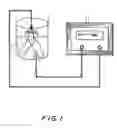 Fig. 02 - Methods and compositions for treating renal failure