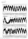 Fig. 06 - Stimulation of CPT-1 as a means to reduce weight