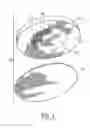 Fig. 02 - Pretreatment method and system for enhancing transdermal drug delivery