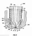 Fig. 12 - Injection molding nozzle