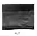 Fig. 05 - Sheet having a rough feel