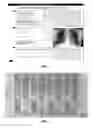 Fig. 05 - Printing and detecting a fixer pattern on a medium