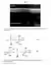 Fig. 02 - Aluminum phosphate compounds, compositions, materials and related composites