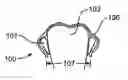 Fig. 01 - Systems and methods for improved engagement between aligners and teeth