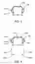 Fig. 07 - Systems and methods for improved engagement between aligners and teeth