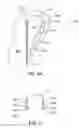 Fig. 08 - Systems and methods for improved engagement between aligners and teeth