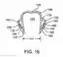 Fig. 23 - Systems and methods for improved engagement between aligners and teeth