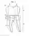 Fig. 02 - Endodontic instrument for accessing a pulp chamber
