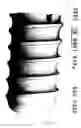 Fig. 03 - Ceramic dental implant