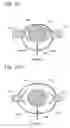Fig. 11 - Three-dimensional in-vitro spinal models and methods of analyzing substance distribution therein