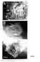 Fig. 06 - Cryopreservation of pluripotent stem cells
