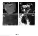 Fig. 07 - Cryopreservation of pluripotent stem cells